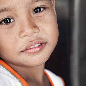 La desnutrición trae múltiples complicaciones para los niños y niñas
